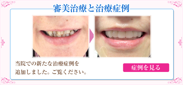 審美治療と治療症例